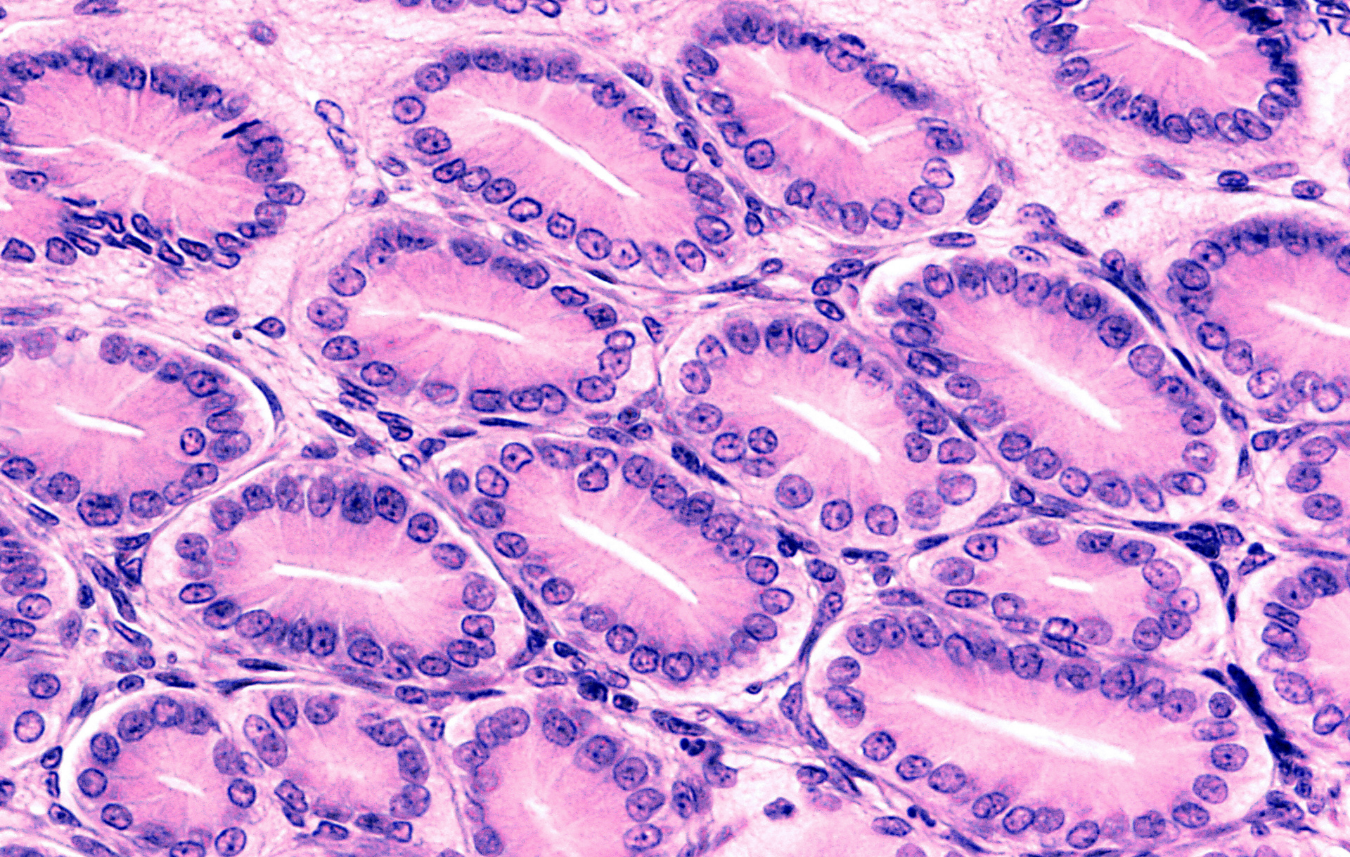Module D: Oxydo-Inflammatoire